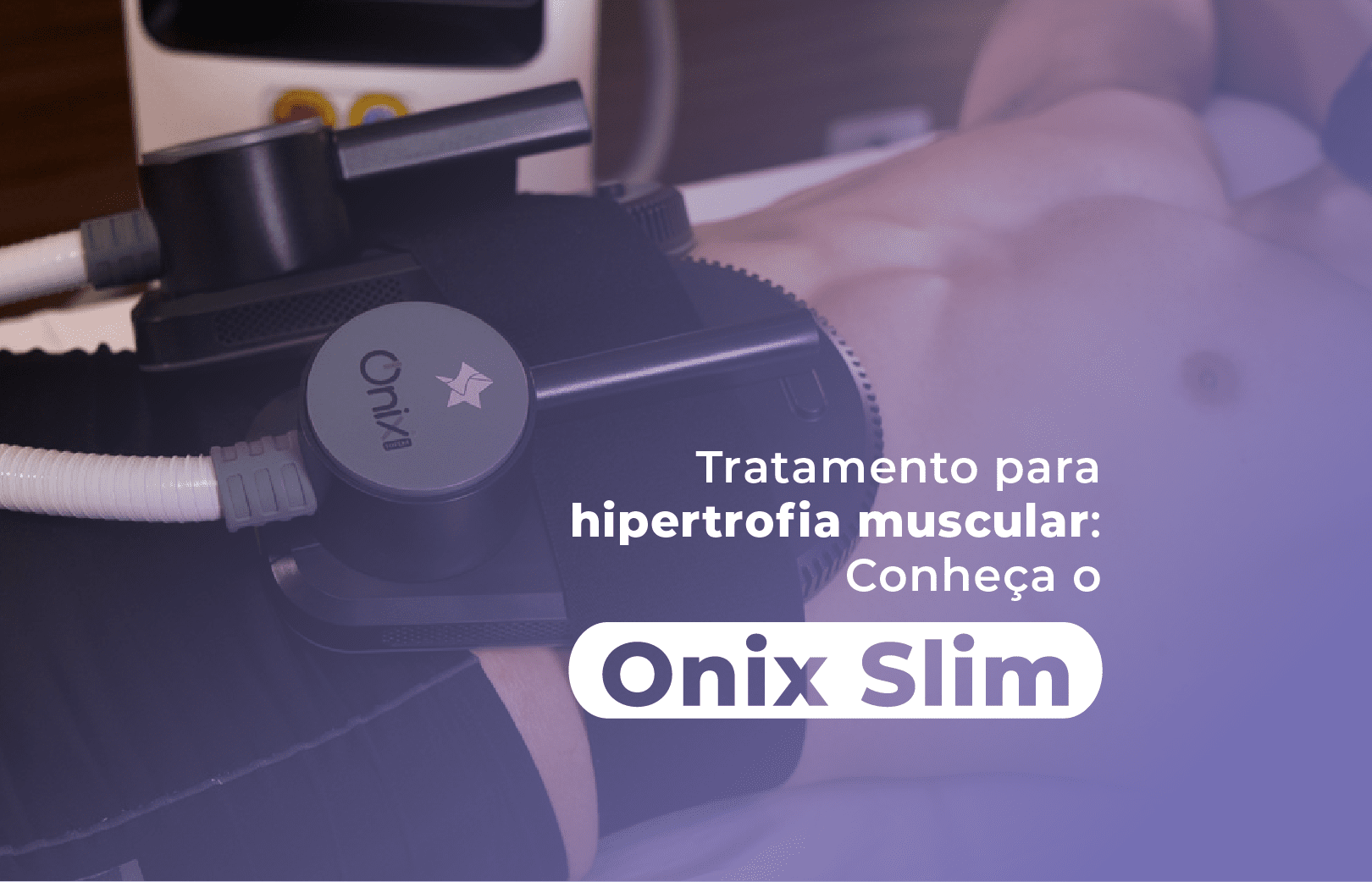 Tratamento para hipertrofia muscular: conheça o Onix Slim