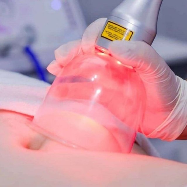 Vacum Laser MMO - Aparelho De Vacuoterapia e Fototerapia + Kit Ventosas Faciais