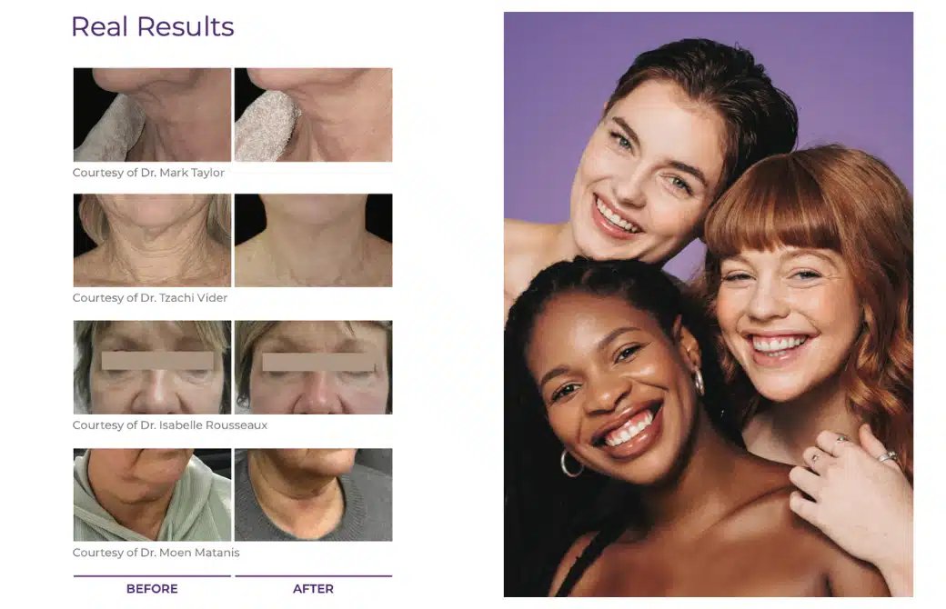 Endymed | Celebrim | Equipamentos Médicos e de Estética Avançada