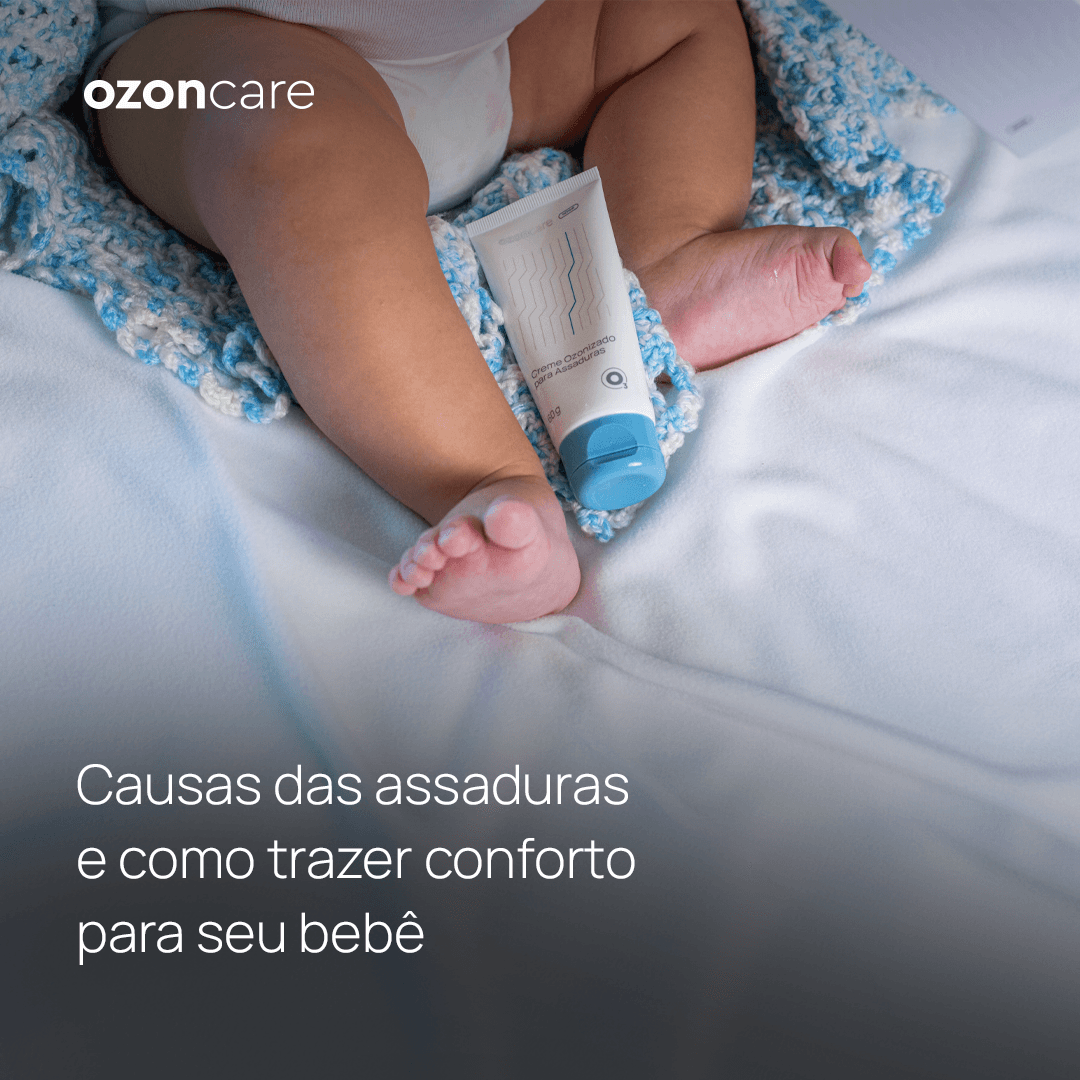 Ozoncare - Causas das assaduras e como trazer conforto para seu bebê ...