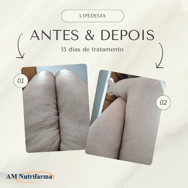 Fórmula Lipedema (Diosmina 900mg + Hesperidina 100mg) - 30 Cápsulas ...